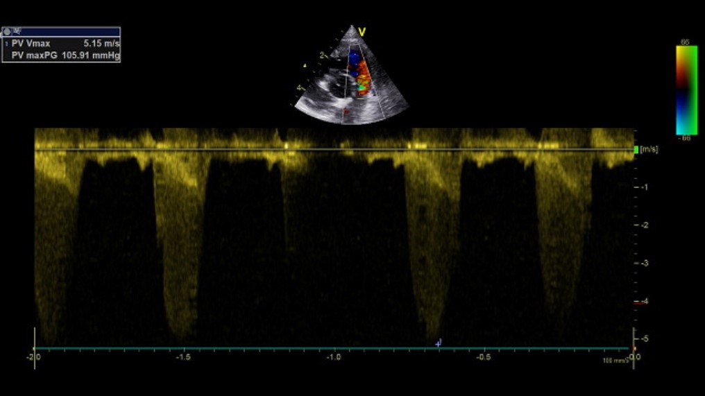 Leveregler fra flere årtier med kardiologi