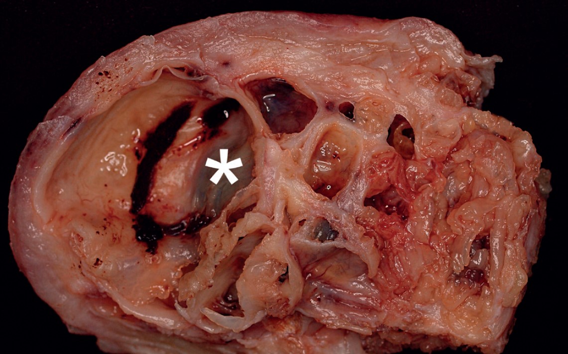 10.04.2021: Equin Tumordiagnostik – anvendelige parametre | DYRLÆGEN