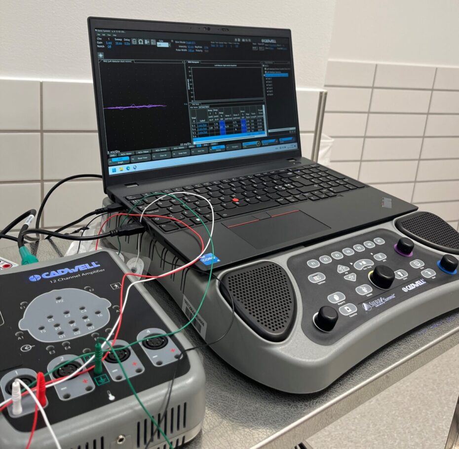 Den elektriskeaktivitet i muskler og nerver måles med EMG, blandt andet til udredning af monopareser.