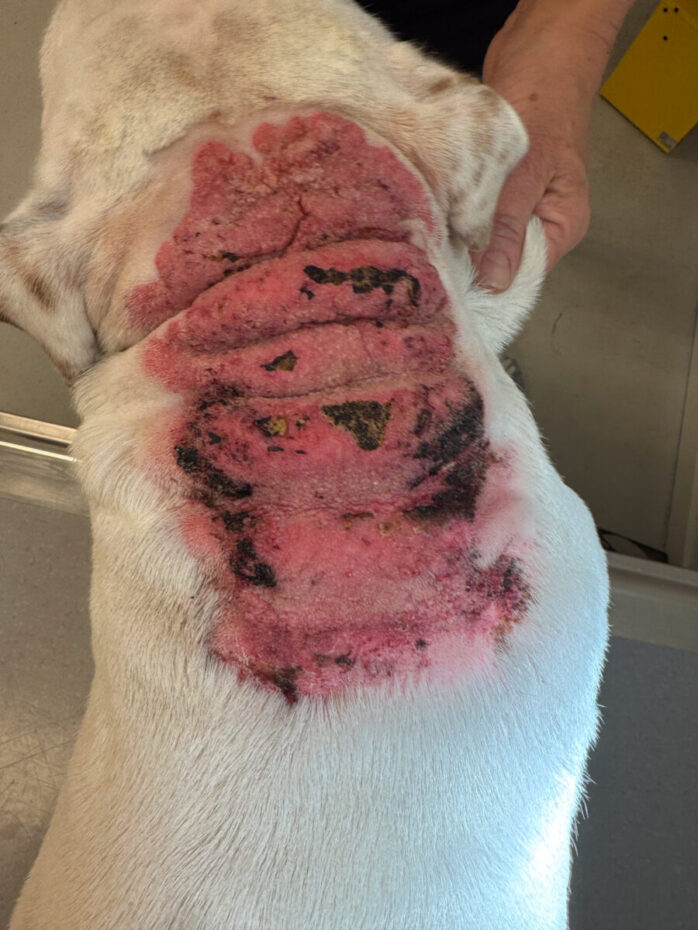 Calcinosis cutis - ryggen