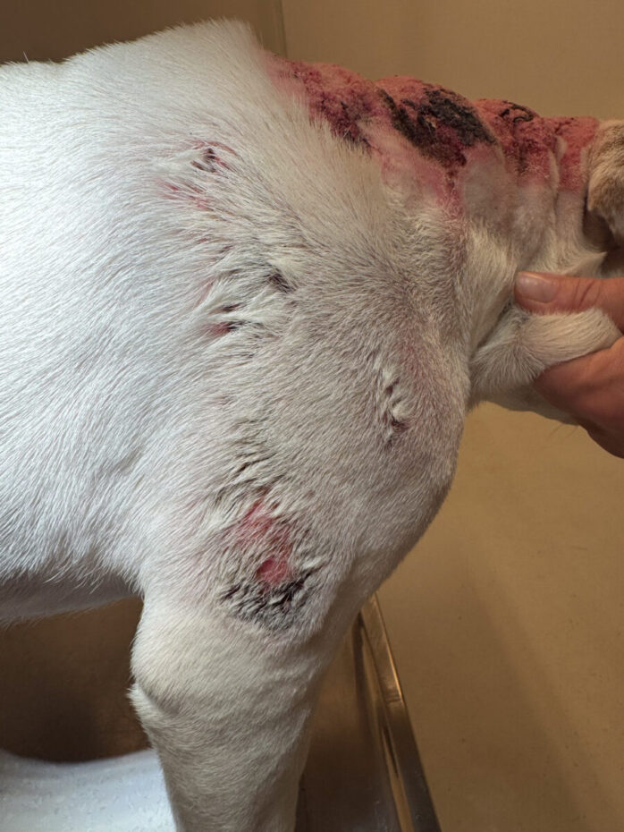 Calcinosis cutis - hale