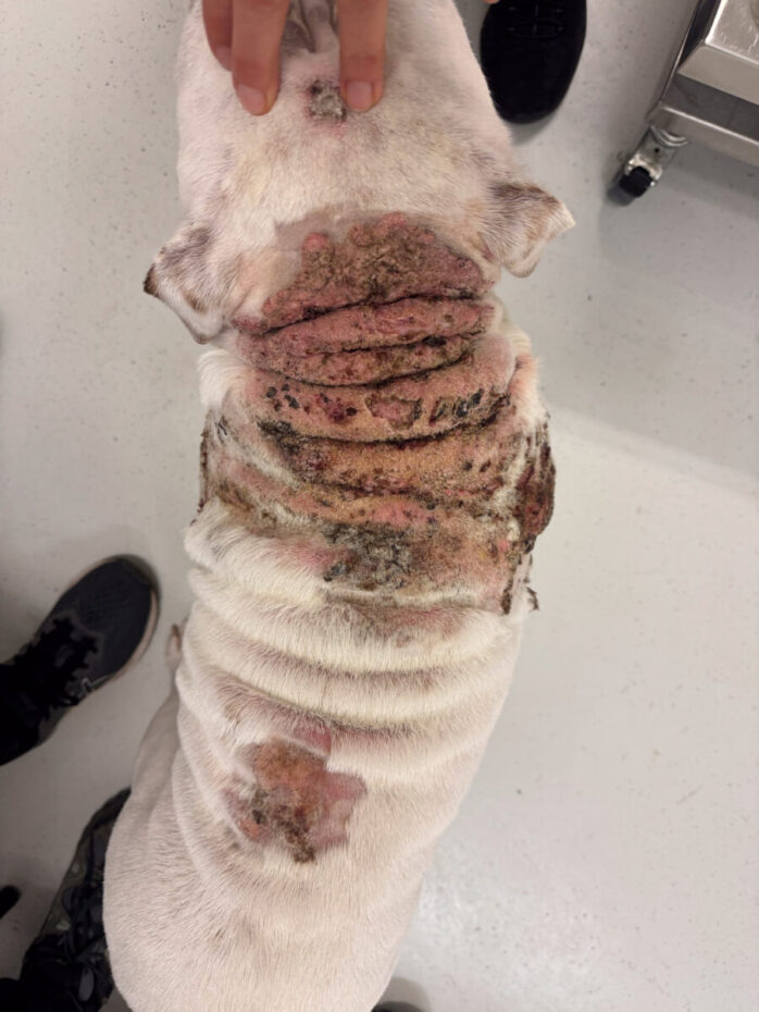 Calcinosis cutis - ryggen