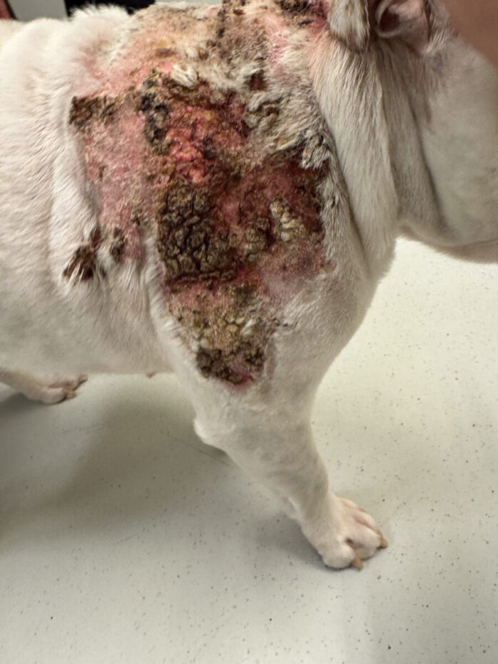 Calcinosis cutis - siden