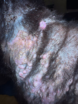 Klassisk udseende for calcinosis cutis-læsioner.Hårde noduli og plaques i huden, alopeci, errythem og cruster.