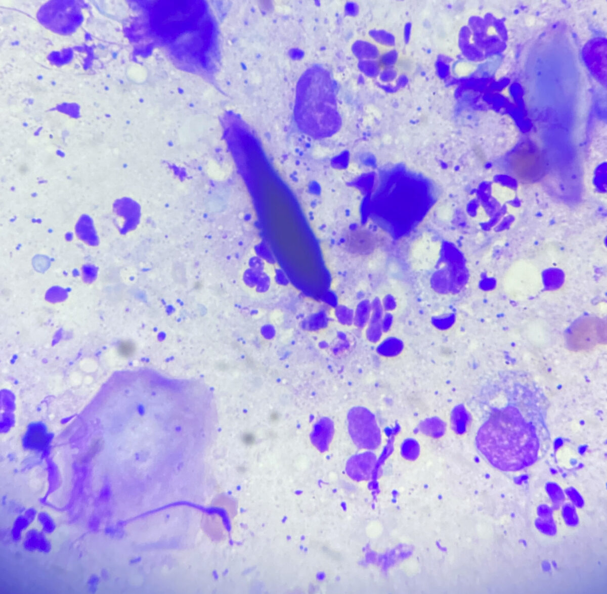 Aftrykspræparat af en sekundær bakteriel infektion.